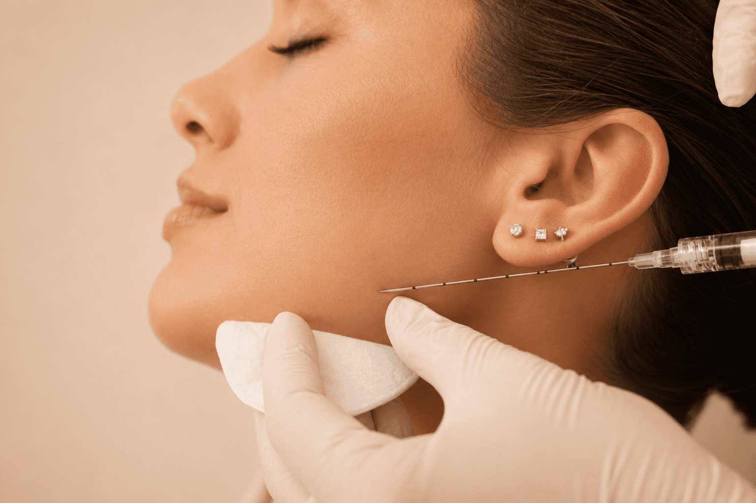 Facial Fillers